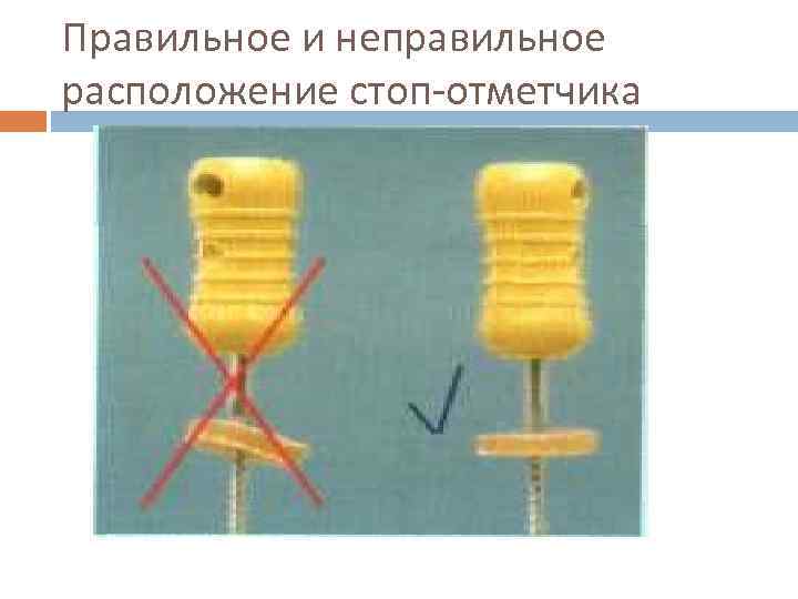 Правильное и неправильное расположение стоп отметчика 