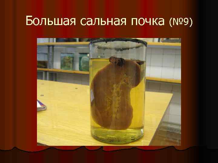 Большая сальная почка (№ 9) 