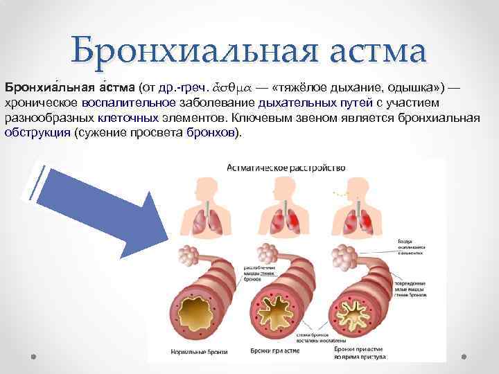 Бронхиальная астма Бронхиа льная а стма (от др. -греч. ἆσθμα — «тяжёлое дыхание, одышка»