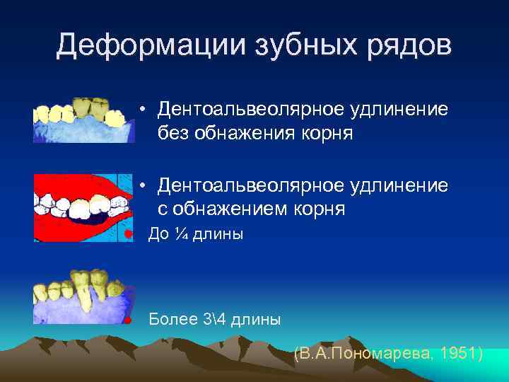 Деформации зубных рядов • Дентоальвеолярное удлинение без обнажения корня • Дентоальвеолярное удлинение с обнажением