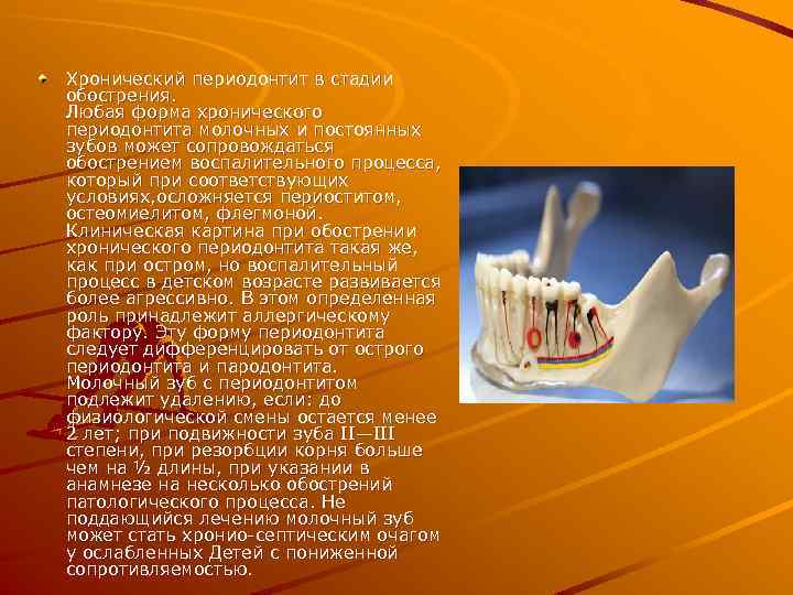 Хронический периодонтит в стадии обострения. Любая форма хронического периодонтита молочных и постоянных зубов может