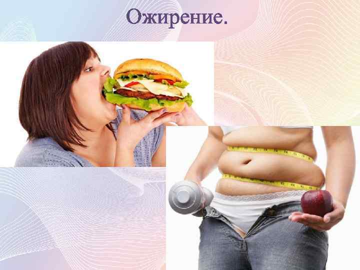 Ожирение. 