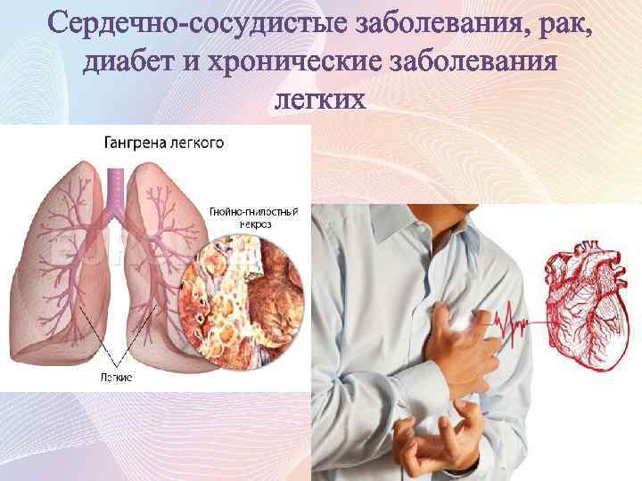 Сердечно-сосудистые заболевания, рак, диабет и хронические заболевания легких 