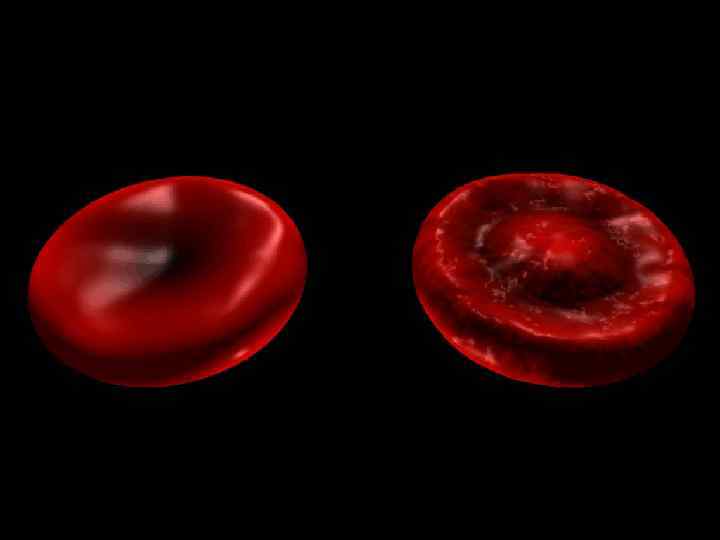 Мишеневидные эритроциты Встречаются при железодефицитной анемии, талассемии, гемоглобинопатиях С, S, наследственной кодоцитарной анемии 