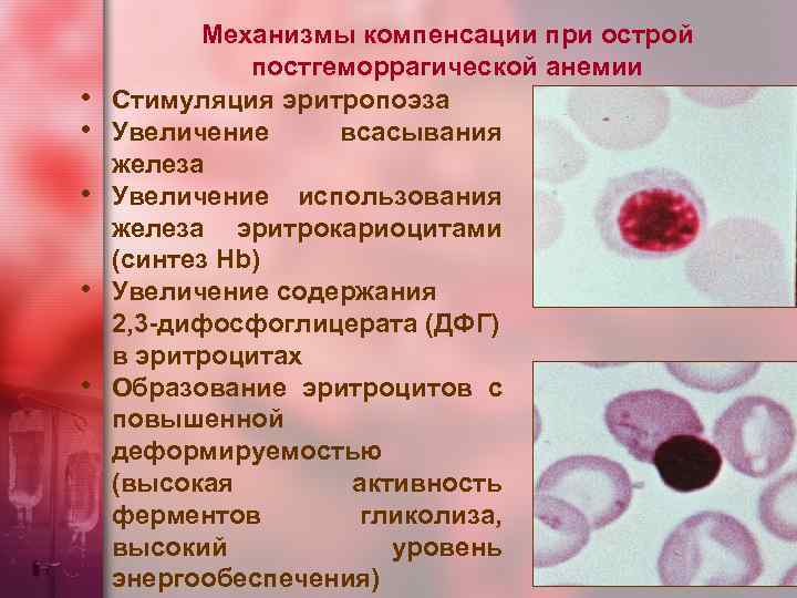  • • • Механизмы компенсации при острой постгеморрагической анемии Стимуляция эритропоэза Увеличение всасывания