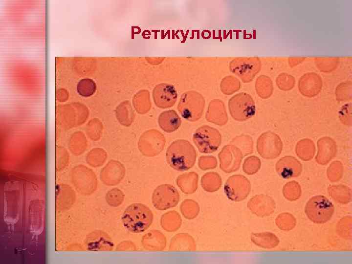 Повышение ретикулоцитов в крови. Ретикулоциты 1.9. Ретикулоциты анемия. Предшественники - ретикулоциты. Ретикулоциты при анемии.