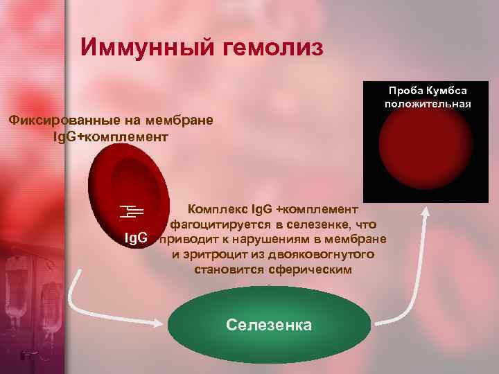 Иммунный гемолиз Проба Кумбса положительная Фиксированные на мембране Ig. G+комплемент Комплекс Ig. G +комплемент