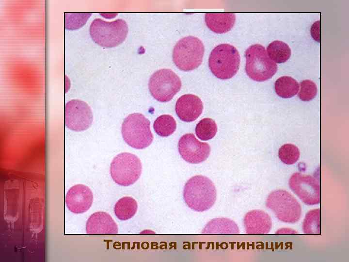 Тепловая агглютинация 