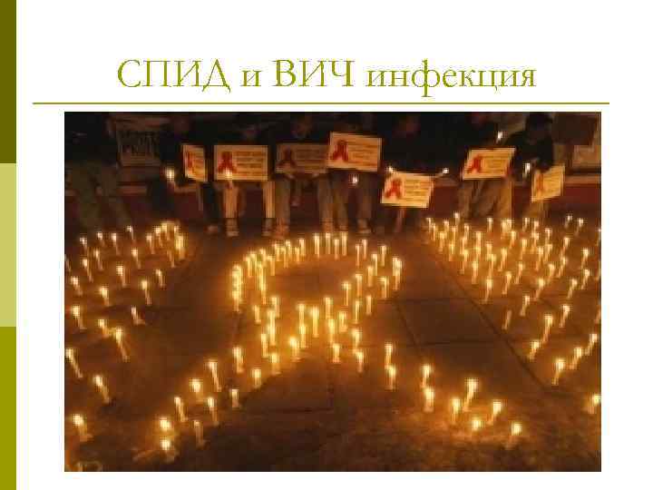 СПИД и ВИЧ инфекция 