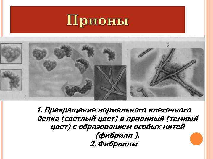 Прионы 1. Превращение нормального клеточного белка (светлый цвет) в прионный (темный цвет) с образованием