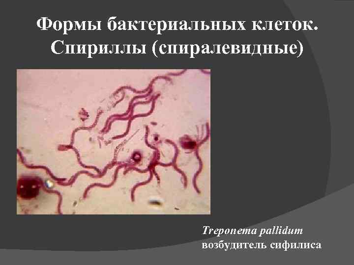 Формы бактериальных клеток. Спириллы (спиралевидные) Treponema pallidum возбудитель сифилиса 