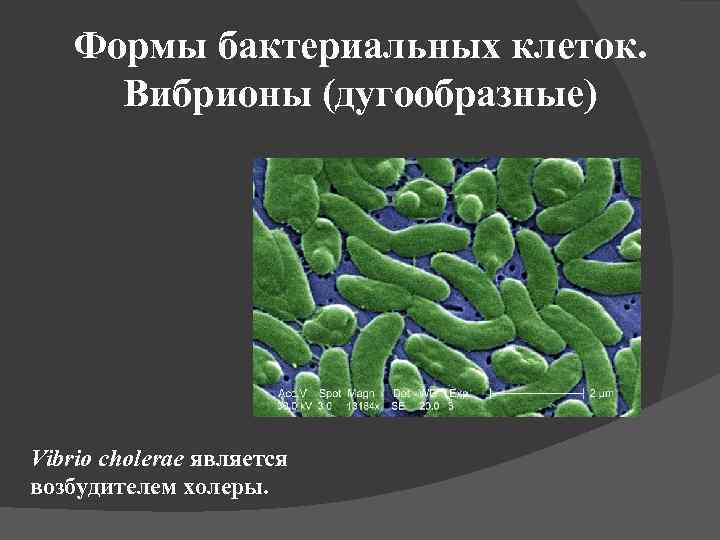 Формы бактериальных клеток. Вибрионы (дугообразные) Vibrio cholerae является возбудителем холеры. 