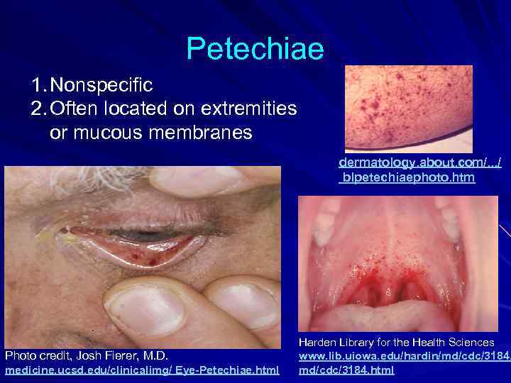 Petechiae 1. Nonspecific 2. Often located on extremities or mucous membranes dermatology. about. com/.