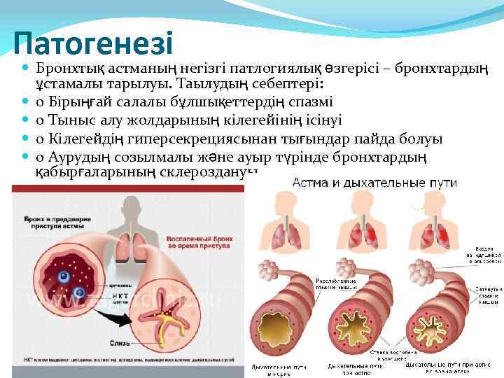 Патогенезі Бронхтық астманың негізгі патлогиялық өзгерісі – бронхтардың ұстамалы тарылуы. Таылудың себептері: o Бірыңғай