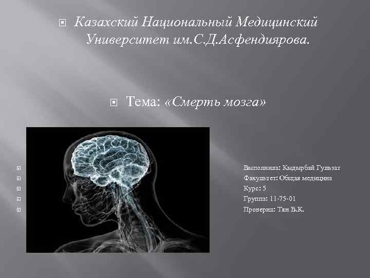  Казахский Национальный Медицинский Университет им. С. Д. Асфендиярова. Тема: «Смерть мозга» Выполнила: Кыдырбай