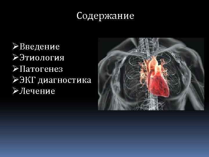 Содержание ØВведение ØЭтиология ØПатогенез ØЭКГ диагностика ØЛечение 
