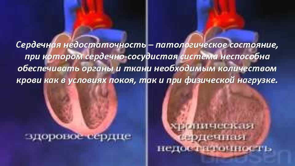 Сердечная недостаточность – патологическое состояние, при котором сердечно-сосудистая система неспособна обеспечивать органы и ткани