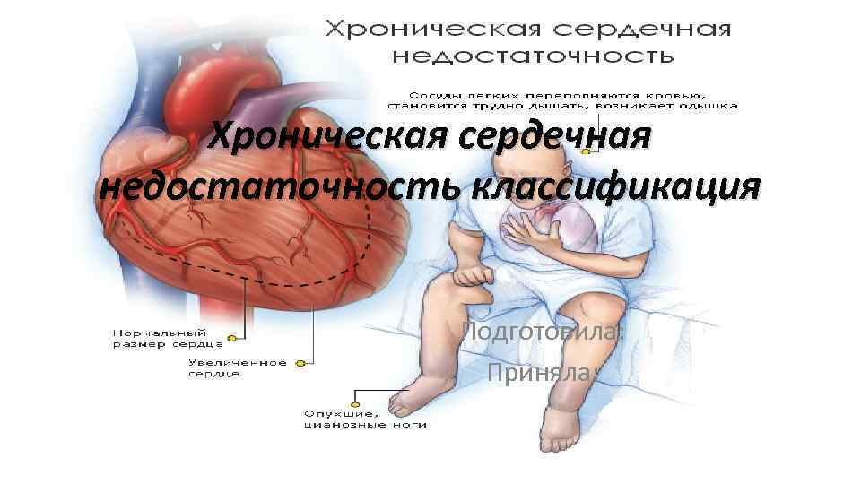 Хроническая сердечная недостаточность классификация Подготовила: Приняла: 