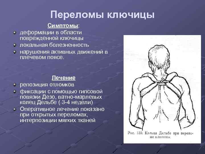 Переломы ключицы Симптомы: деформации в области поврежденной ключицы локальная болезненность нарушения активных движений в