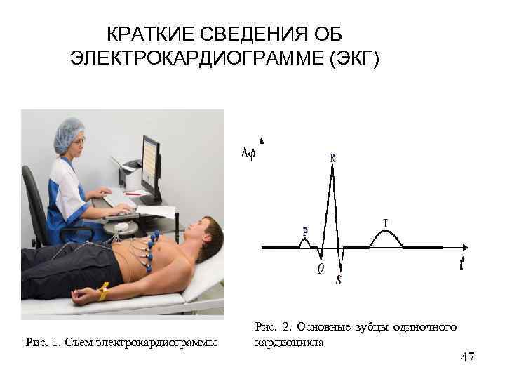 КРАТКИЕ СВЕДЕНИЯ ОБ ЭЛЕКТРОКАРДИОГРАММЕ (ЭКГ) Рис. 1. Съем электрокардиограммы Рис. 2. Основные зубцы одиночного