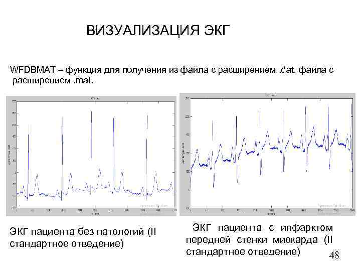 ВИЗУАЛИЗАЦИЯ ЭКГ WFDBMAT – функция для получения из файла с расширением. dat, файла с