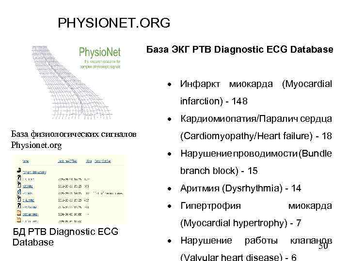 PHYSIONET. ORG База ЭКГ PTB Diagnostic ECG Database Инфаркт миокарда (Myocardial infarction) - 148