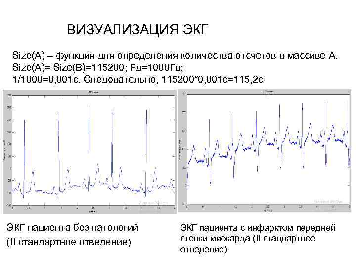 ВИЗУАЛИЗАЦИЯ ЭКГ Size(A) – функция для определения количества отсчетов в массиве A. Size(A)= Size(B)=115200;