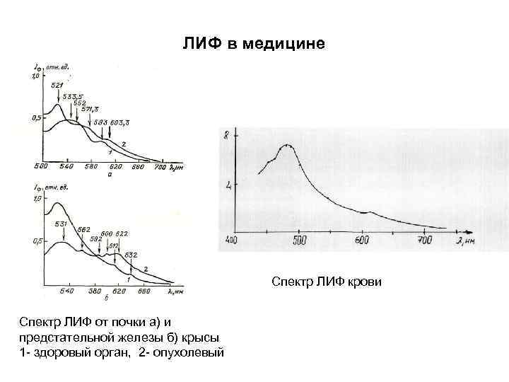 ЛИФ в медицине Спектр ЛИФ крови Спектр ЛИФ от почки а) и предстательной железы