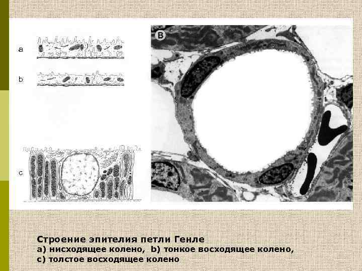 a b c Строение эпителия петли Генле a) нисходящее колено, b) тонкое восходящее колено,