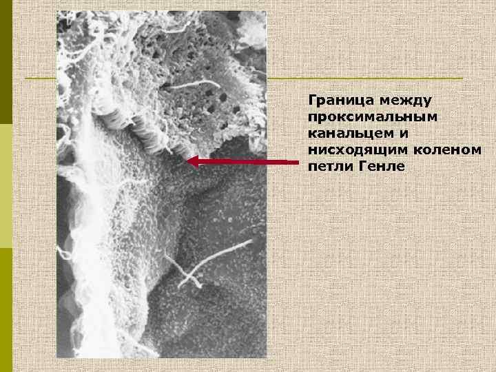 Граница между проксимальным канальцем и нисходящим коленом петли Генле 