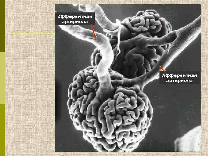 Эфферентная артериола Афферентная артериола 