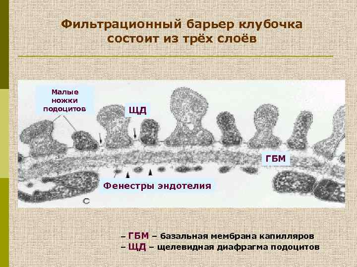 Базальная мембрана клубочка. Фильтрационный барьер физиология. Фильтрационный барьер почки. Строение фильтрационного барьера почки. Базальная мембрана фильтрационного барьера.