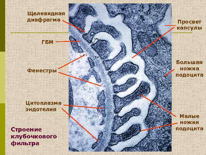 Щелевидная диафрагма Просвет капсулы ГБМ Фенестры Большая ножка подоцита Цитоплазма эндотелия Строение клубочкового фильтра