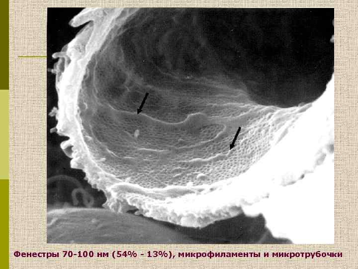 Фенестры 70 -100 нм (54% - 13%), микрофиламенты и микротрубочки 