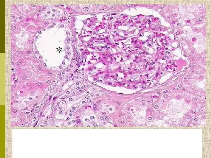 The asterisk marks the macula densa in the kidney. The macula densa is a