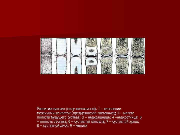 Развитие сустава (полу схематично). 1 – скопление мезенхимных клеток (предхрящевое состояние); 2 – мессто