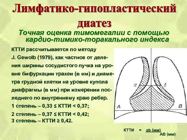 Точная оценка тимомегалии с помощью кардио-тимико-торакального индекса КТТИ рассчитывается по методу J. Gewolb (1979),