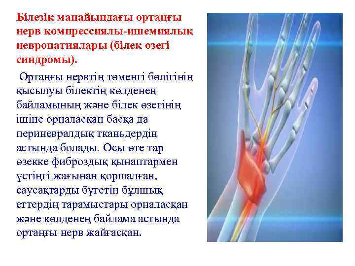 Білезік маңайындағы ортаңғы нерв компрессиялы-ишемиялық невропатиялары (білек өзегі синдромы). Ортаңғы нервтің төменгі бөлігінің қысылуы