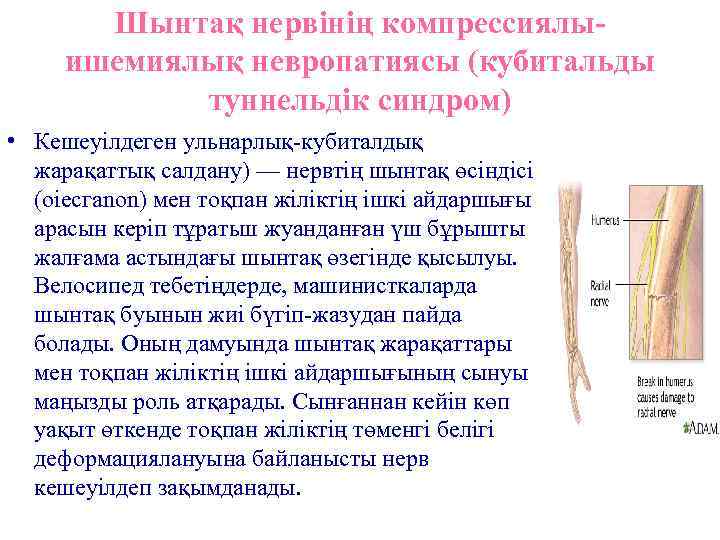 Шынтақ нервінің компрессиялыишемиялық невропатиясы (кубитальды туннельдік синдром) • Кешеуілдеген ульнарлық-кубиталдық жарақаттық салдану) — нервтің