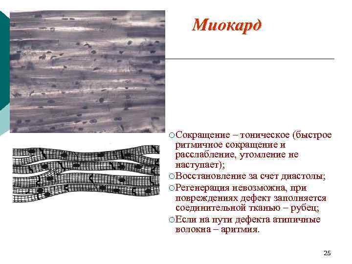 Миокард ¡ Сокращение – тоническое (быстрое ритмичное сокращение и расслабление, утомление не наступает); ¡