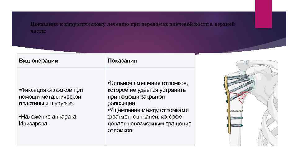 Показания к хирургическому лечению при переломах плечевой кости в верхней части: Вид операции •