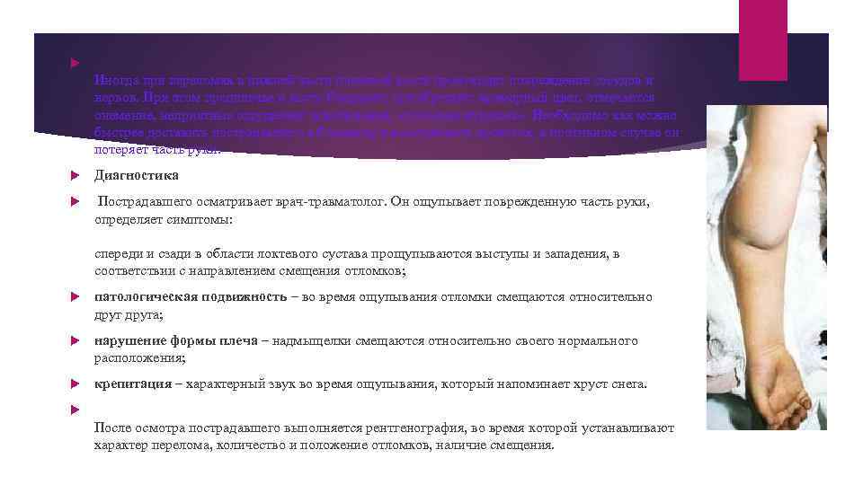  Иногда при переломах в нижней части плечевой кости происходит повреждение сосудов и нервов.