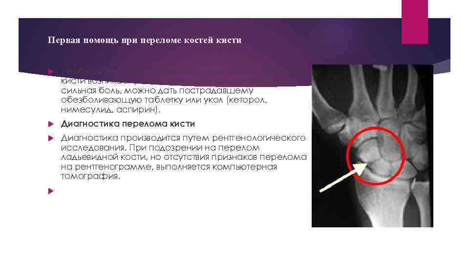 Первая помощь при переломе костей кисти Необходимость накладывания шины при повреждении кисти возникает редко.