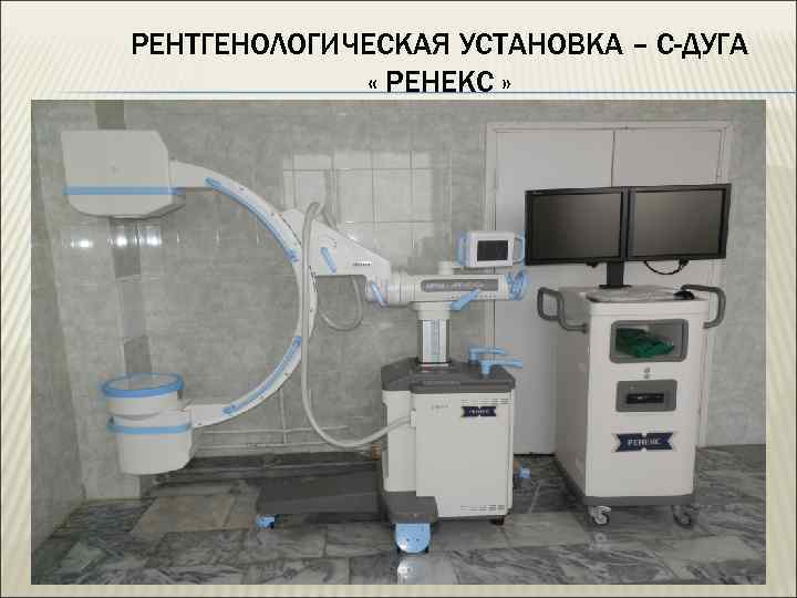 РЕНТГЕНОЛОГИЧЕСКАЯ УСТАНОВКА – С-ДУГА « РЕНЕКС » 