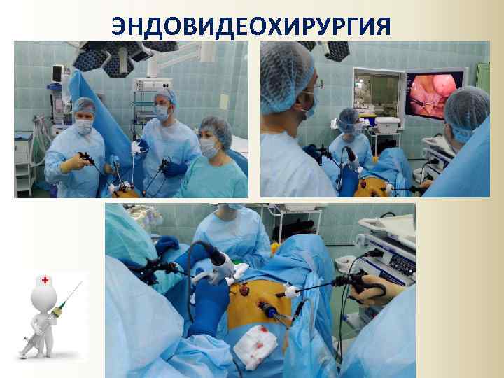 ЭНДОВИДЕОХИРУРГИЯ 