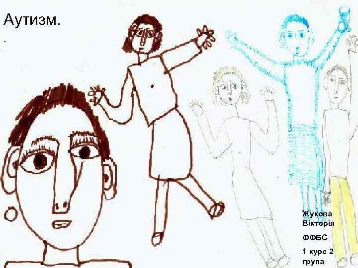 Аутизм. . Жукова Вікторія ФФБС 1 курс 2 група 