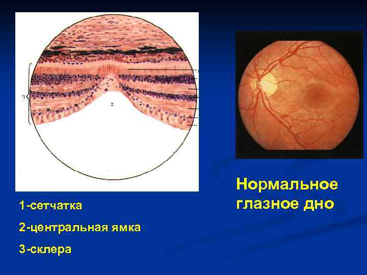 Функция сетчатки. Центральная ямка желтое пятно сетчатки. Центральная ямка сетчатки. Пятно и Центральная ямка сетчатки. Центральная ямка сетчатки функция.