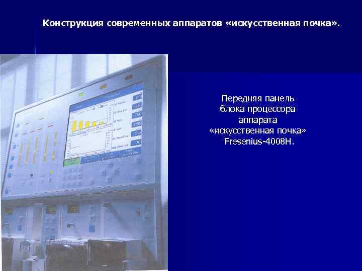 Конструкция современных аппаратов «искусственная почка» . Передняя панель блока процессора аппарата «искусственная почка» Fresenius-4008