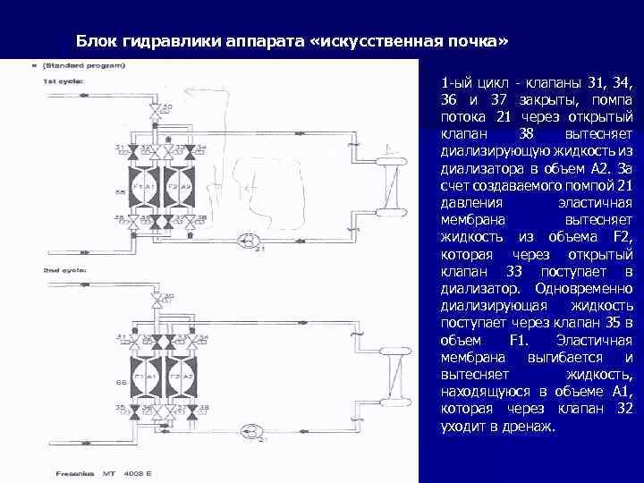 Блок гидравлики аппарата «искусственная почка» 1 -ый цикл - клапаны 31, 34, 36 и