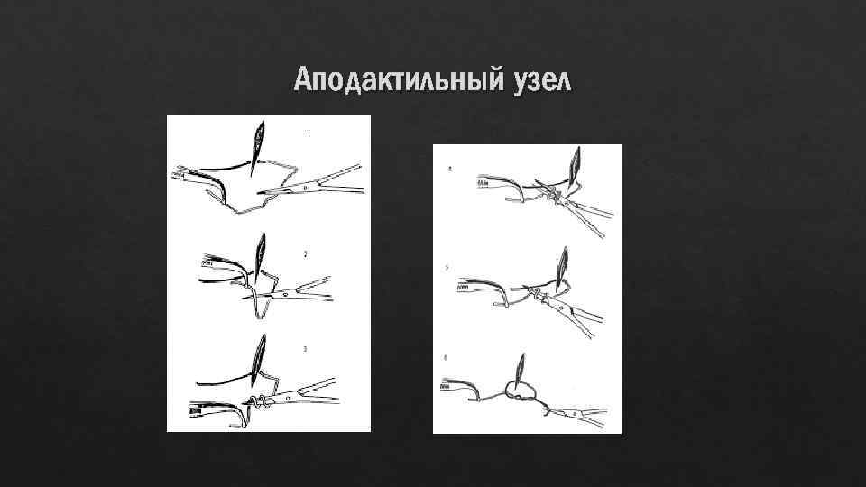 Аподактильный узел 